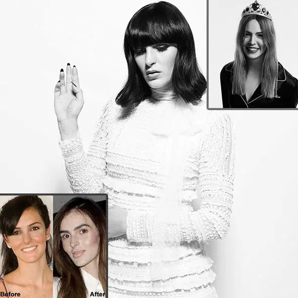 Model Ali Lohan's Boyfriend: Making Her Own Mark, Looks Very Different, Plastic Surgery?