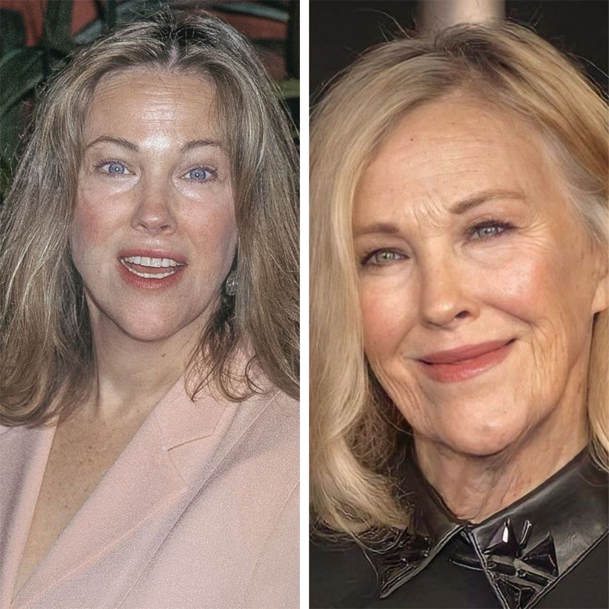 Catherine O'Hara Before & After Plastic Surgery