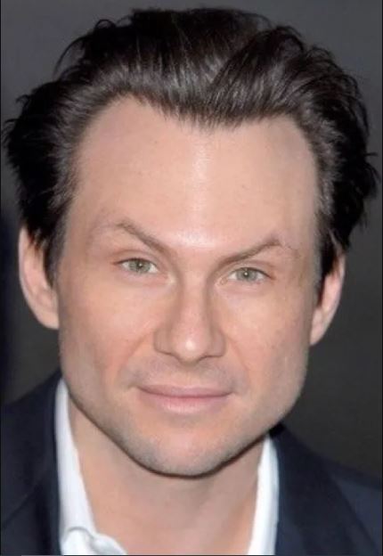 Christian Slater after plastic surgery