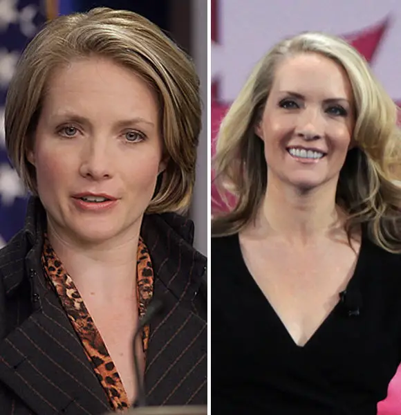 Did Dana Perino Undergo Plastic Surgery? - Change In Her Nose & Eyes?