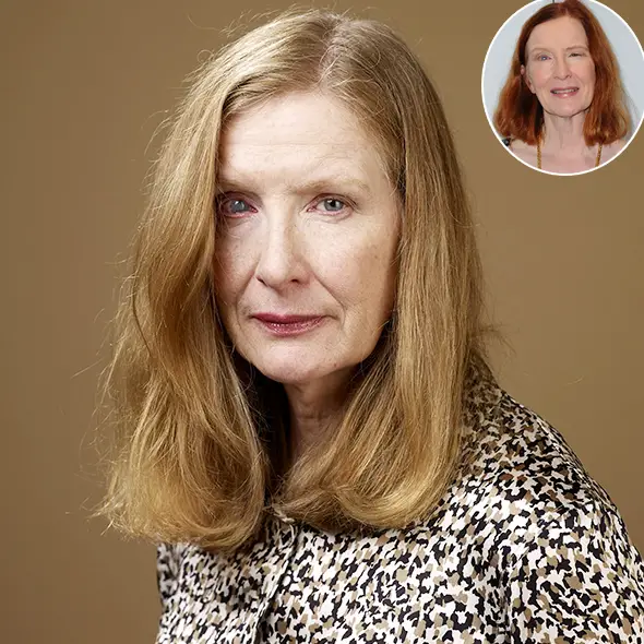 Frances Conroy and All The Quires Related To The Accident That Caused Her One Eye To Be Different Has Been Revealed