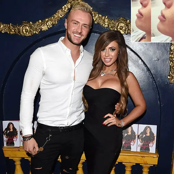 While Prolifically Dating Her Boyfriend, Holly Hagan Gets Lashed Out For Before And After 'Chin' Picture