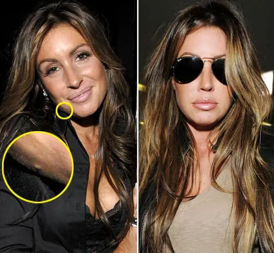 Rachel Uchitel's Plastic Surgery