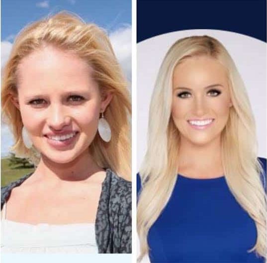 Speculated differences on Tomi Lahren's Pre and Post Plastic Surgery Pictures
