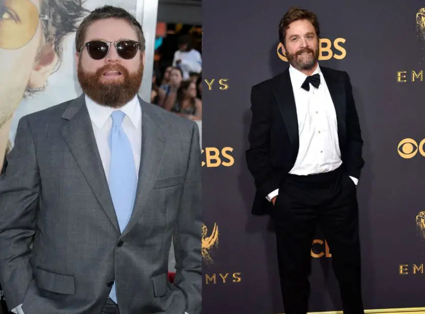 Zach Galifianakis after his weight loss