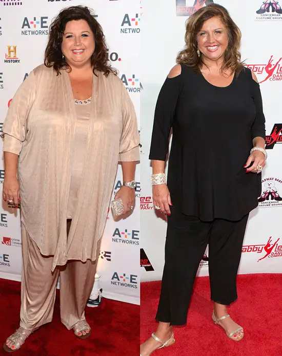 Abby Lee Miller Before and After the Weight Loss