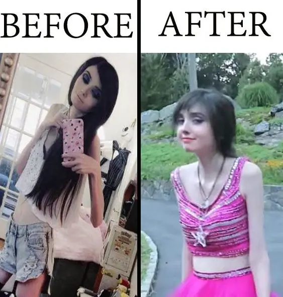 Eugenia Cooney before and after seeking the assistance of a medical profess...