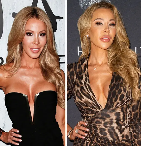 Lisa Hochstein Admits to Having Too Much Fillers In the Past